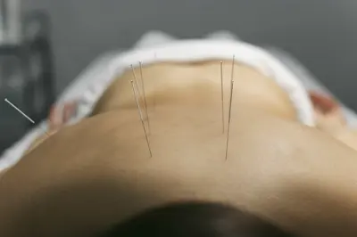 acupuncture process client