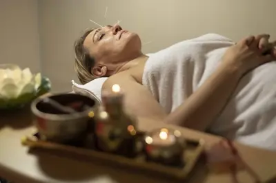 adult woman acupuncture